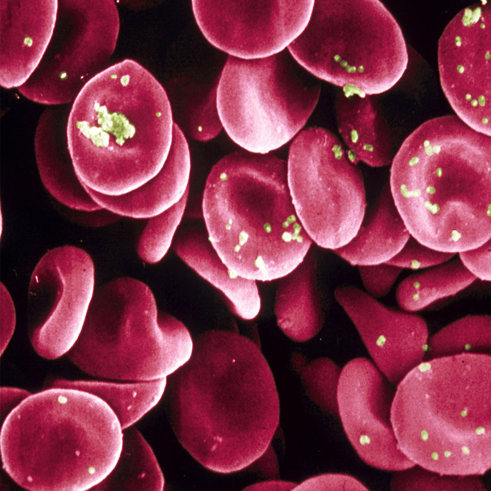 P4DP22 – Rote Blutkörperchen. Rasterelektronenmikroskop –